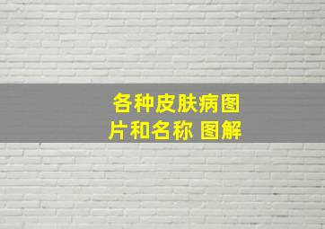 各种皮肤病图片和名称 图解